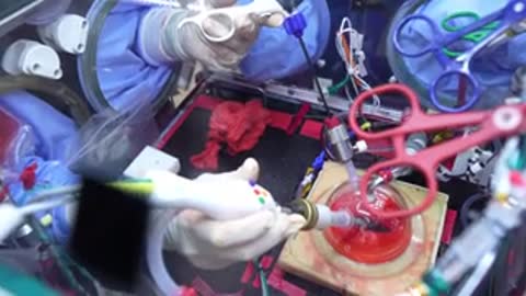 Hands operating surgical tools over a red specimen model inside a container.