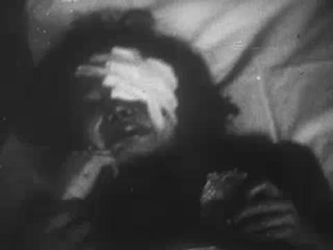 Injured child with bandaged eye cries in bed, holding a doll.