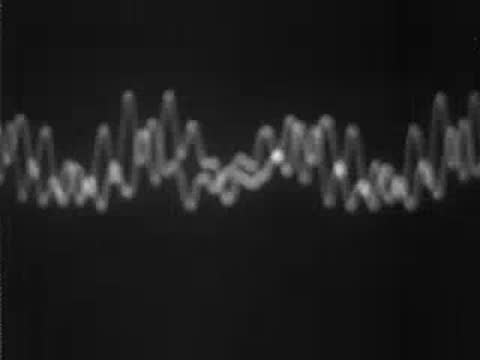 oscilloscope screen displaying complex sound waves