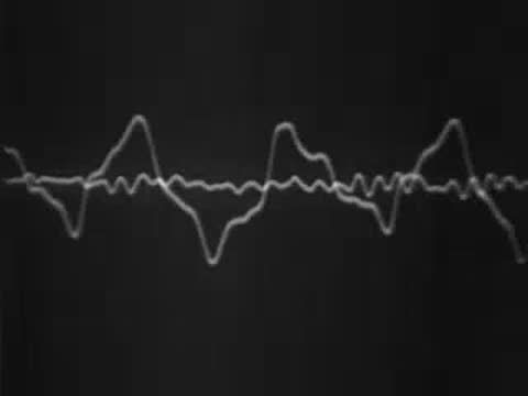 oscilloscope screen displaying sound waves ending in a flat line