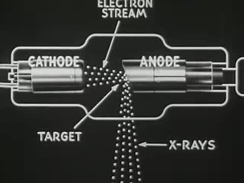 Animated diagram showing electron stream hitting the anode target and producing X-rays.