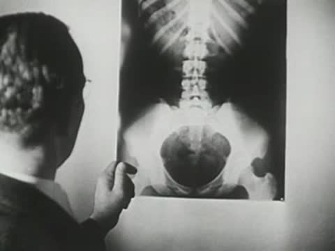 Doctor examines large X-ray films on a light box in a clinical setting.