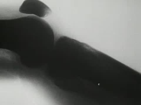 X-ray fluoroscopy footage showing moving joints of a human knee.