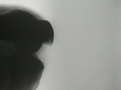 X-ray fluoroscopy footage showing bending motion of a human knee joint.