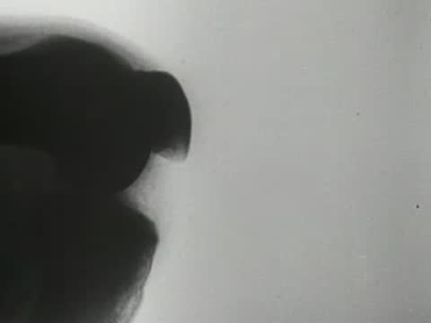 X-ray fluoroscopy footage showing continuous movement of knee and leg bones.