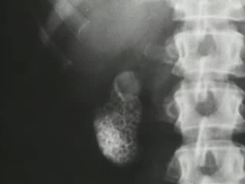 X-ray showing internal organs and spine alignment in a human body.