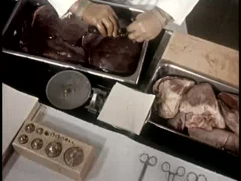 A person examining and weighing organ tissue samples in stainless steel containers